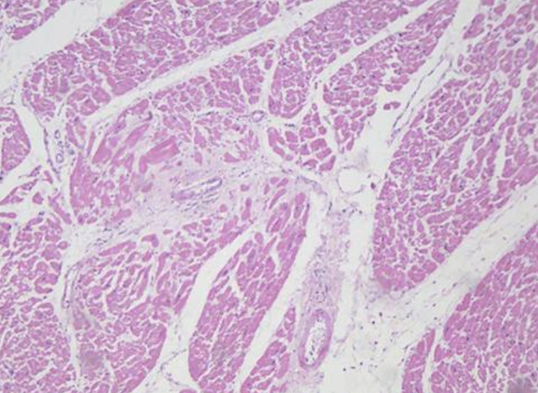 病理切片是什么