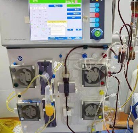 血液透析與濾過的便攜化：為患者提供靈活、高效的治療選擇