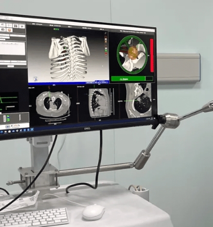 激光手術(shù)導航的便攜時代：精準定位，引領(lǐng)手術(shù)新潮流