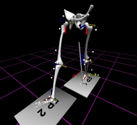智能康復訓練的創(chuàng)新：虛擬現(xiàn)實結(jié)合步態(tài)分析系統(tǒng)的功能與潛力