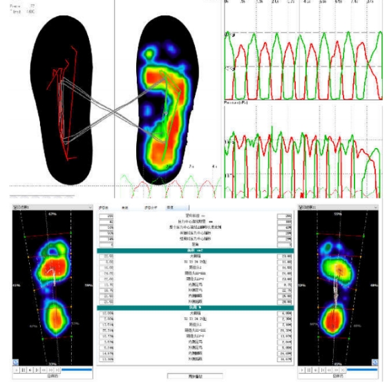 智能康復訓練的創(chuàng)新：可穿戴步態(tài)分析系統(tǒng)的功能與潛力