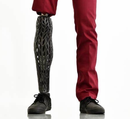 3D打印假肢：個性化解決方案的新時代