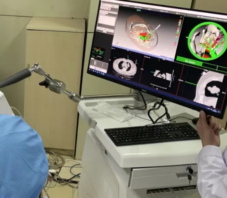 增強(qiáng)現(xiàn)實(shí)(AR)手術(shù)導(dǎo)航系統(tǒng)：提升手術(shù)精準(zhǔn)度