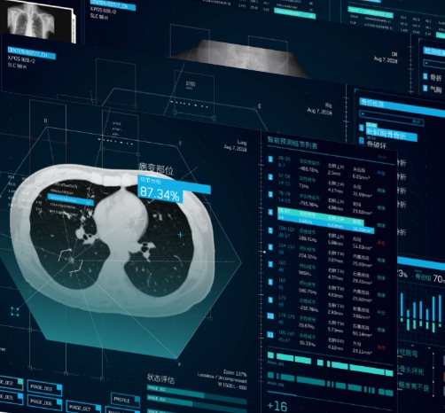 基于AI的影像分析軟件：輔助醫(yī)生做出更準(zhǔn)確診斷