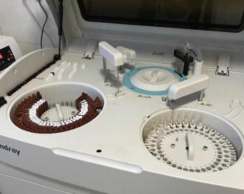 生化指標的精準測量——生化分析儀在代謝性疾病診斷中的價值