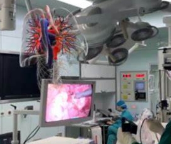 視覺增強，手術(shù)更精準(zhǔn)——醫(yī)用AR輔助手術(shù)系統(tǒng)的工作原理與優(yōu)勢