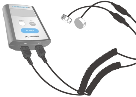 骨折愈合監(jiān)測(cè)儀