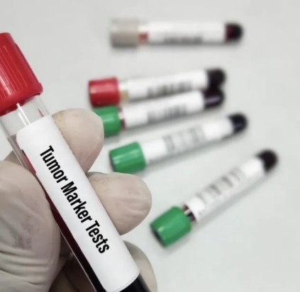 腫瘤標志物檢測系統(tǒng)